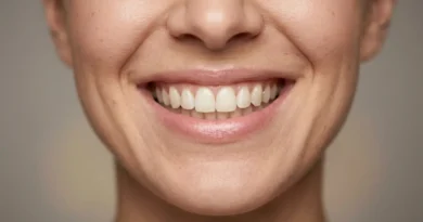 Celebrity dental implants before and after showing a natural even smile